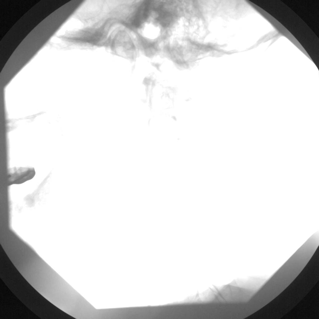 Modality LUT適用前